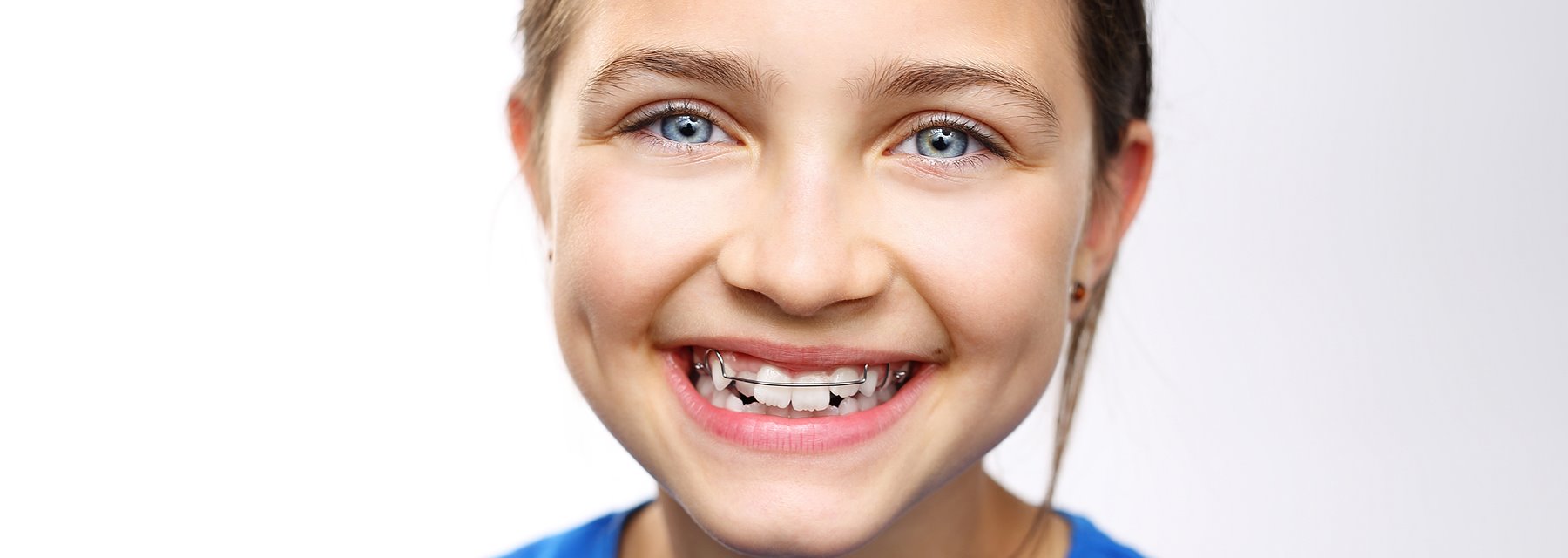 Aligners provider - FRANK P. SCARTOZZI, D.D.S., Closter, New Jersey